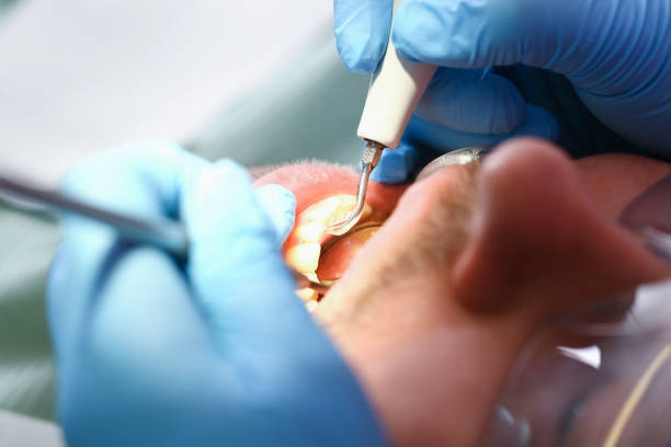 Best Urgent Care for Lost Fillings or Crowns in Athens, TX
